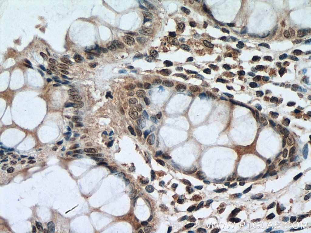 Immunohistochemistry (IHC) staining of human colon tissue using PI3 Kinase p85 Beta Monoclonal antibody (67644-1-Ig)