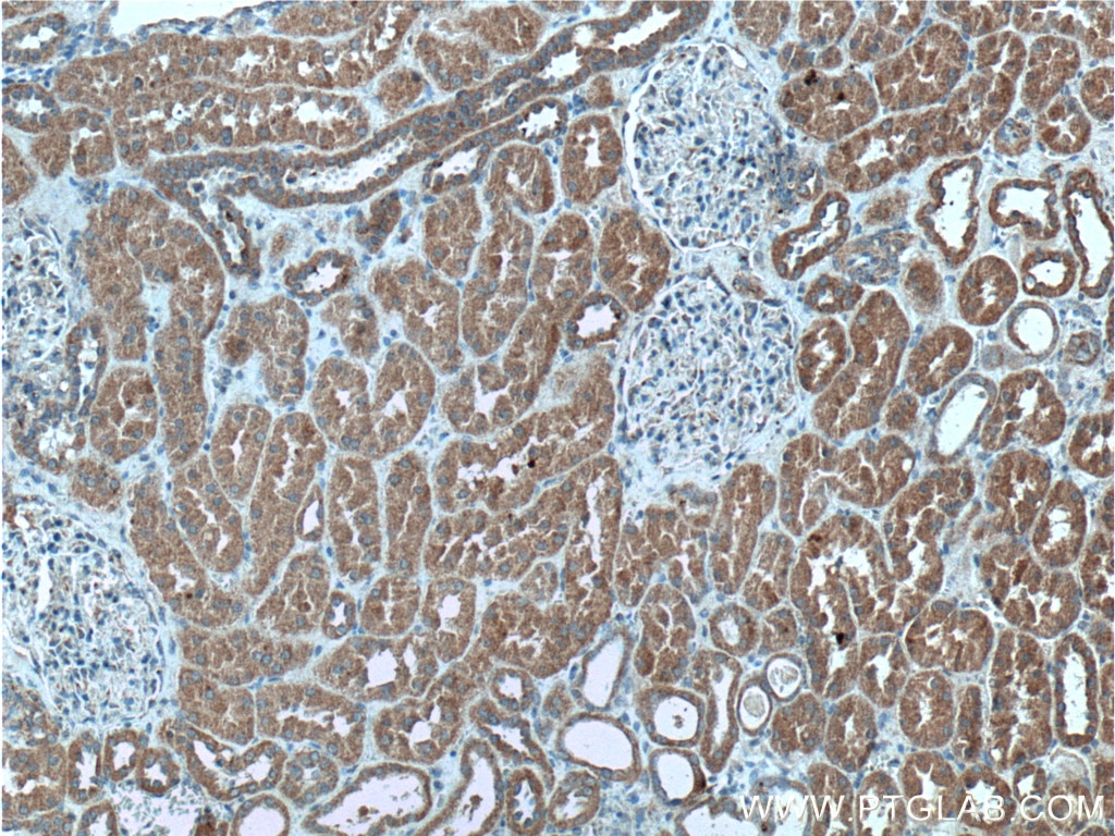 Immunohistochemistry (IHC) staining of human kidney tissue using PI3 Kinase p55 Gamma Polyclonal antibody (27035-1-AP)