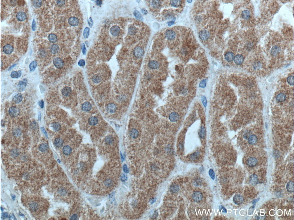 Immunohistochemistry (IHC) staining of human kidney tissue using PI3 Kinase p55 Gamma Polyclonal antibody (27035-1-AP)