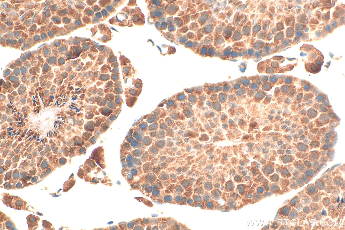 Immunohistochemistry (IHC) staining of mouse testis tissue using PI3 Kinase p55 Gamma Polyclonal antibody (27035-1-AP)