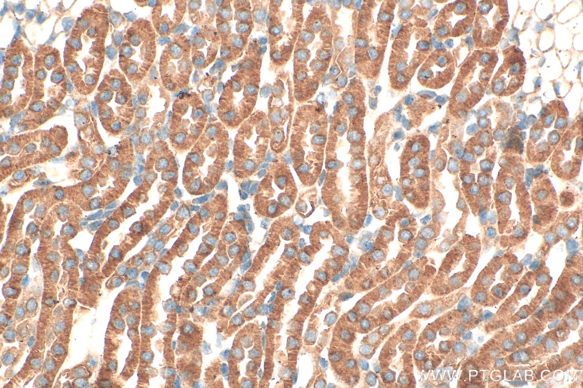 Immunohistochemistry (IHC) staining of mouse kidney tissue using PI3 Kinase p55 Gamma Polyclonal antibody (27035-1-AP)