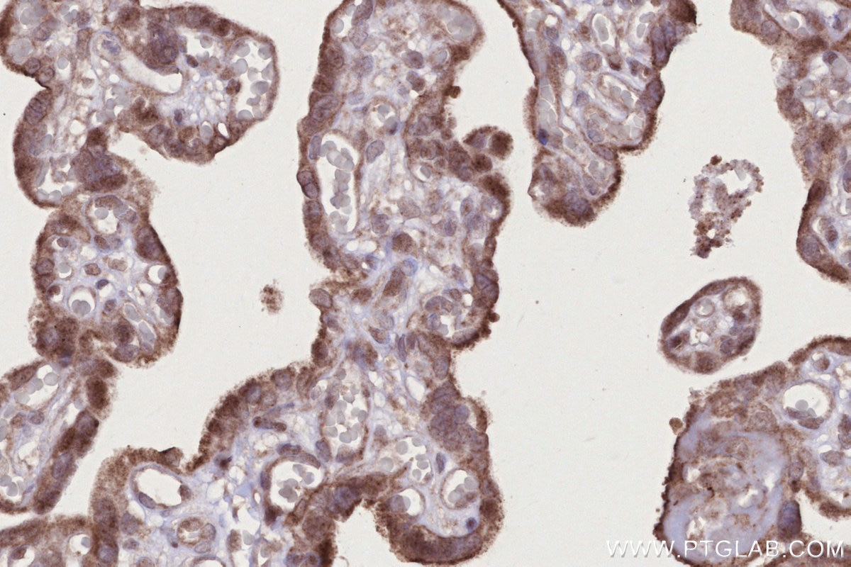 IHC staining of human placenta using 27035-1-AP Immunohistochemistry (IHC) staining of human placenta tissue using PI3 Kinase p55 Gamma Polyclonal antibody (27035-1-AP)
