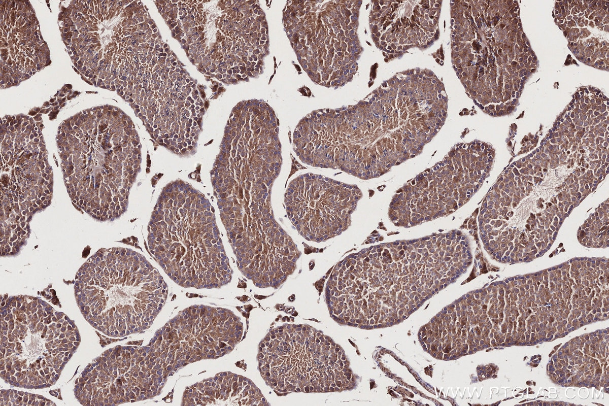 IHC staining of mouse testis using 27035-1-AP Immunohistochemistry (IHC) staining of mouse testis tissue using PI3 Kinase p55 Gamma Polyclonal antibody (27035-1-AP)