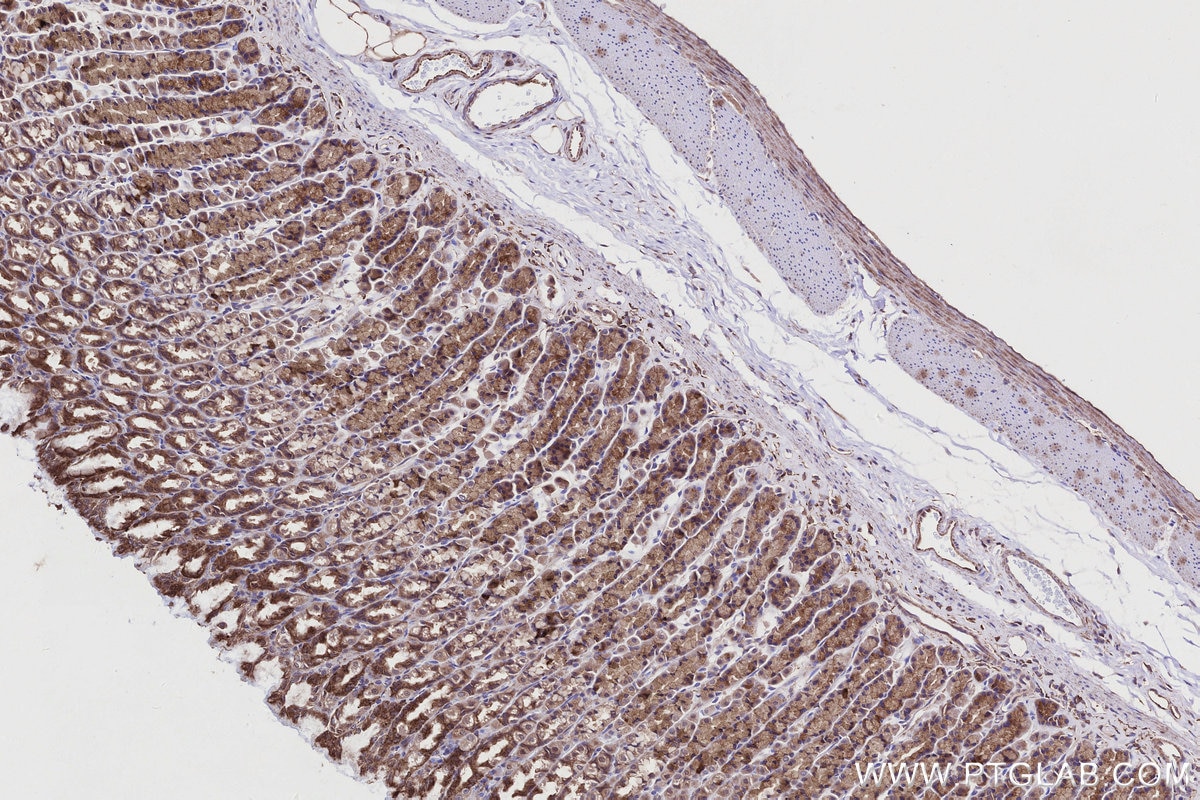 IHC staining of rat stomach using 27035-1-AP Immunohistochemistry (IHC) staining of rat stomach tissue using PI3 Kinase p55 Gamma Polyclonal antibody (27035-1-AP)
