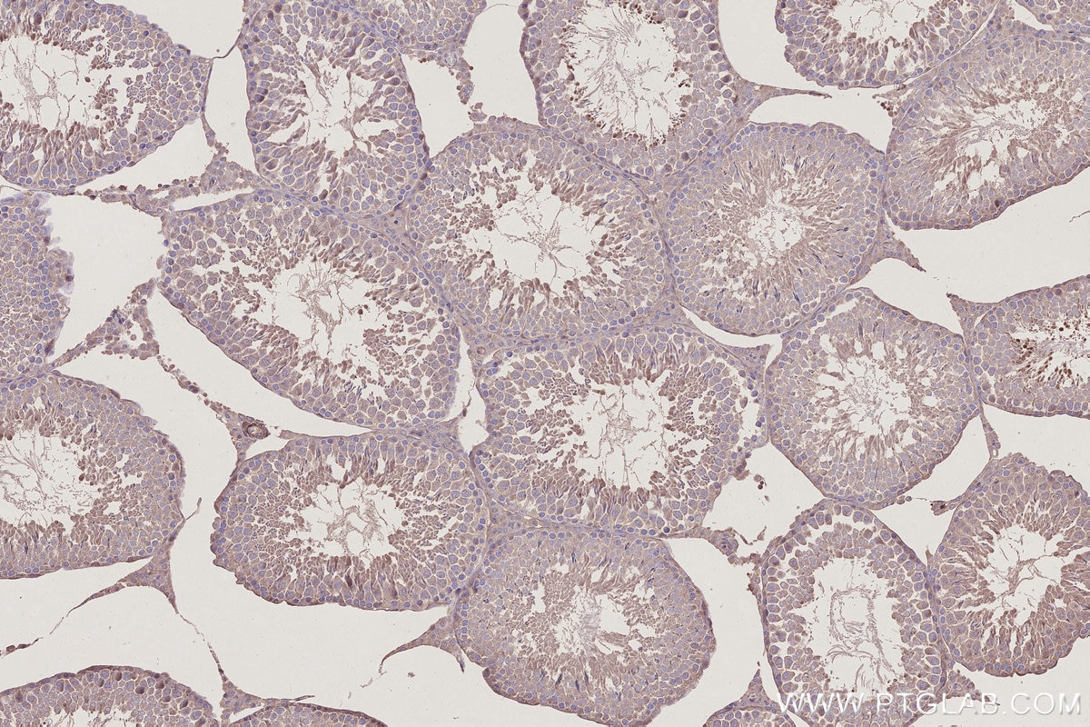 IHC staining of rat testis using 27035-1-AP Immunohistochemistry (IHC) staining of rat testis tissue using PI3 Kinase p55 Gamma Polyclonal antibody (27035-1-AP)