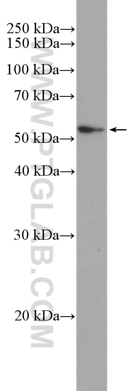 Western Blot (WB) analysis of MCF-7 cells using PI3 Kinase p55 Gamma Polyclonal antibody (27035-1-AP)