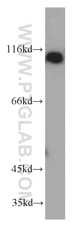 PI3 Kinase p55 Gamma Polyclonal antibody