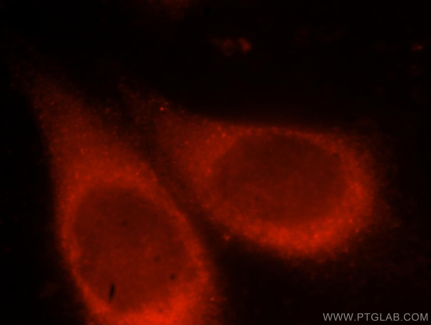 Immunofluorescence (IF) / fluorescent staining of HeLa cells using VPS15 Polyclonal antibody (17894-1-AP)