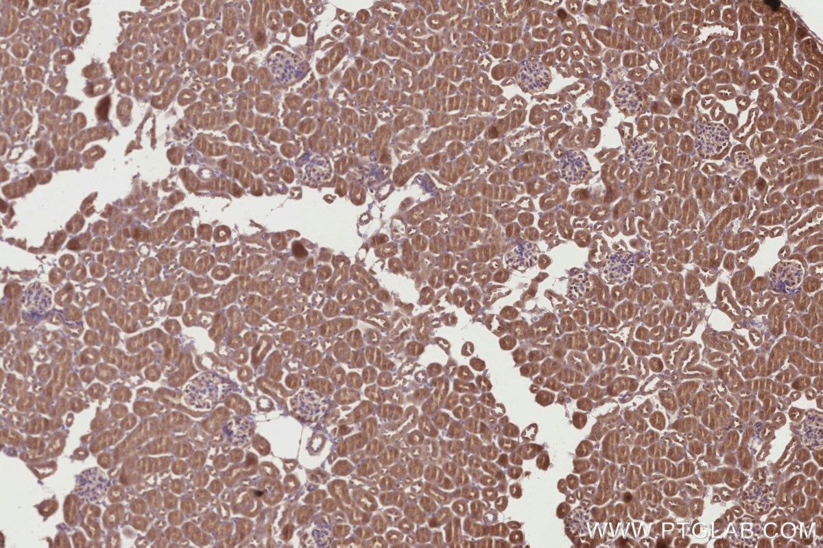Immunohistochemistry (IHC) staining of mouse kidney tissue using VPS15 Polyclonal antibody (17894-1-AP)