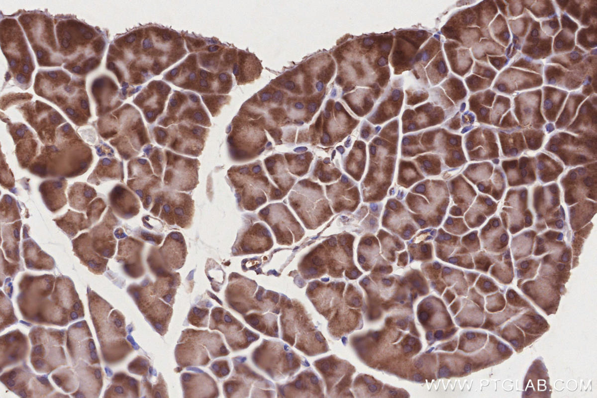 Immunohistochemistry (IHC) staining of mouse pancreas tissue using VPS15 Polyclonal antibody (17894-1-AP)