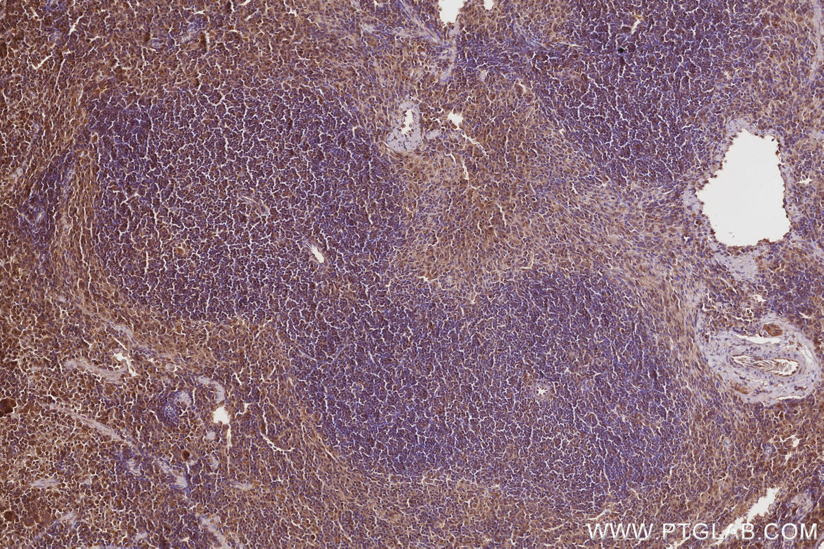 Immunohistochemistry (IHC) staining of mouse spleen tissue using VPS15 Polyclonal antibody (17894-1-AP)