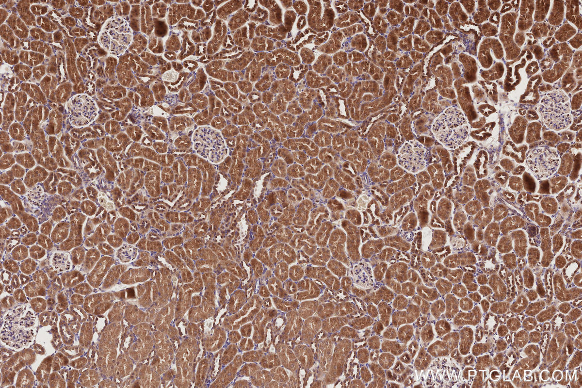 Immunohistochemistry (IHC) staining of rat kidney tissue using VPS15 Polyclonal antibody (17894-1-AP)