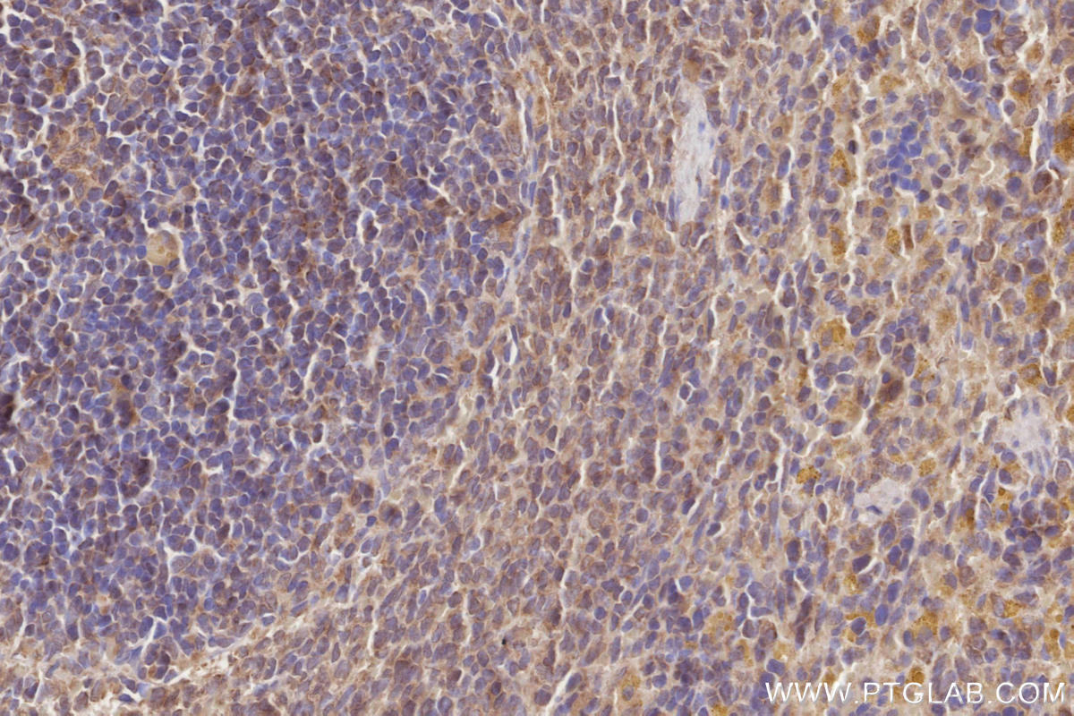 Immunohistochemistry (IHC) staining of rat spleen tissue using VPS15 Polyclonal antibody (17894-1-AP)