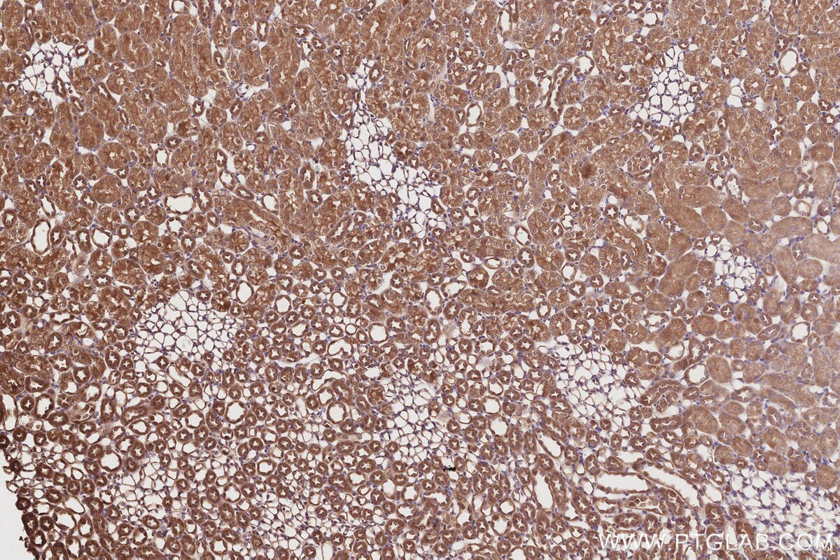 Immunohistochemistry (IHC) staining of rat kidney tissue using VPS15 Polyclonal antibody (17894-1-AP)