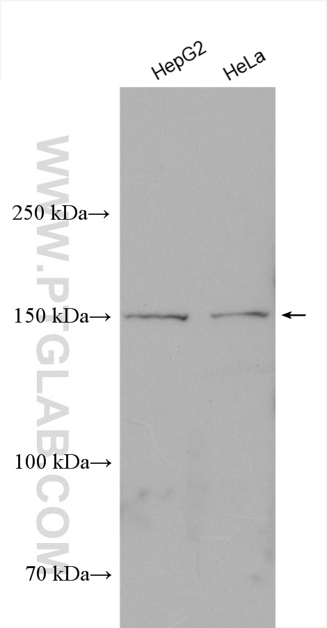 Western Blot (WB) analysis of various lysates using VPS15 Polyclonal antibody (17894-1-AP)