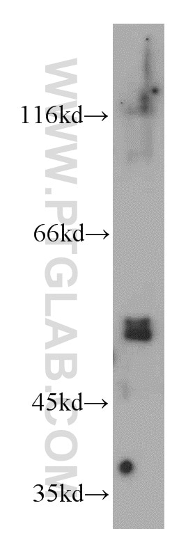 Western Blot (WB) analysis of rat lymph tissue using PI3K p101 Polyclonal antibody (13329-1-AP)