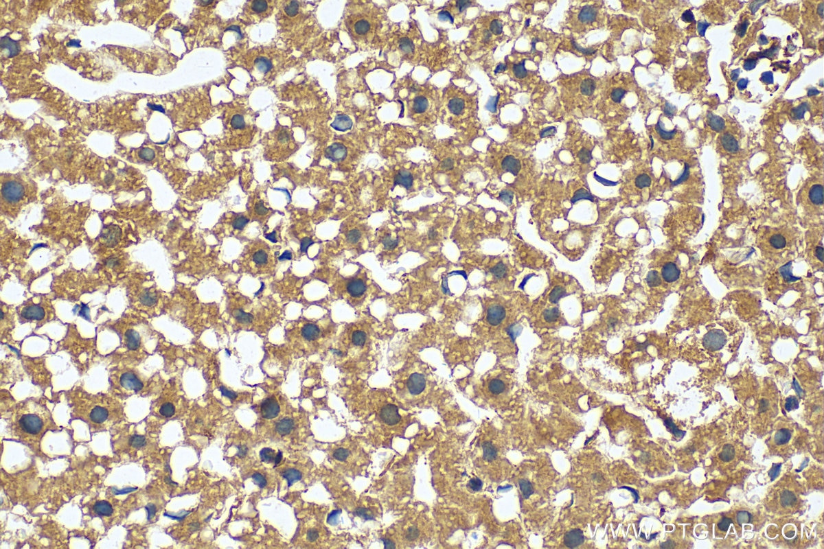 Immunohistochemistry (IHC) staining of mouse liver tissue using PIM2 Polyclonal antibody (25865-1-AP)