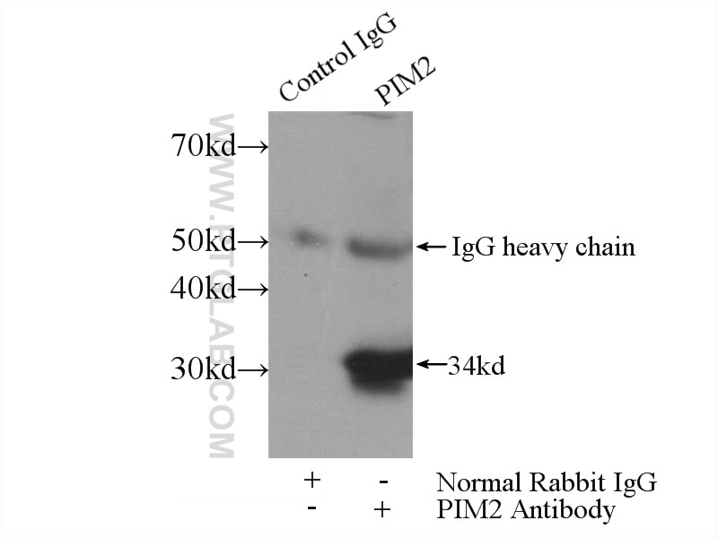 Immunoprecipitation (IP) experiment of Raji cells using PIM2 Polyclonal antibody (25865-1-AP)