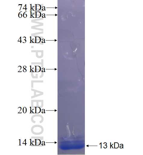 PIM2 fusion protein Ag23139 SDS-PAGE