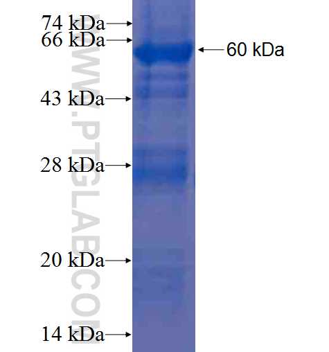 PIM2 fusion protein Ag3126 SDS-PAGE