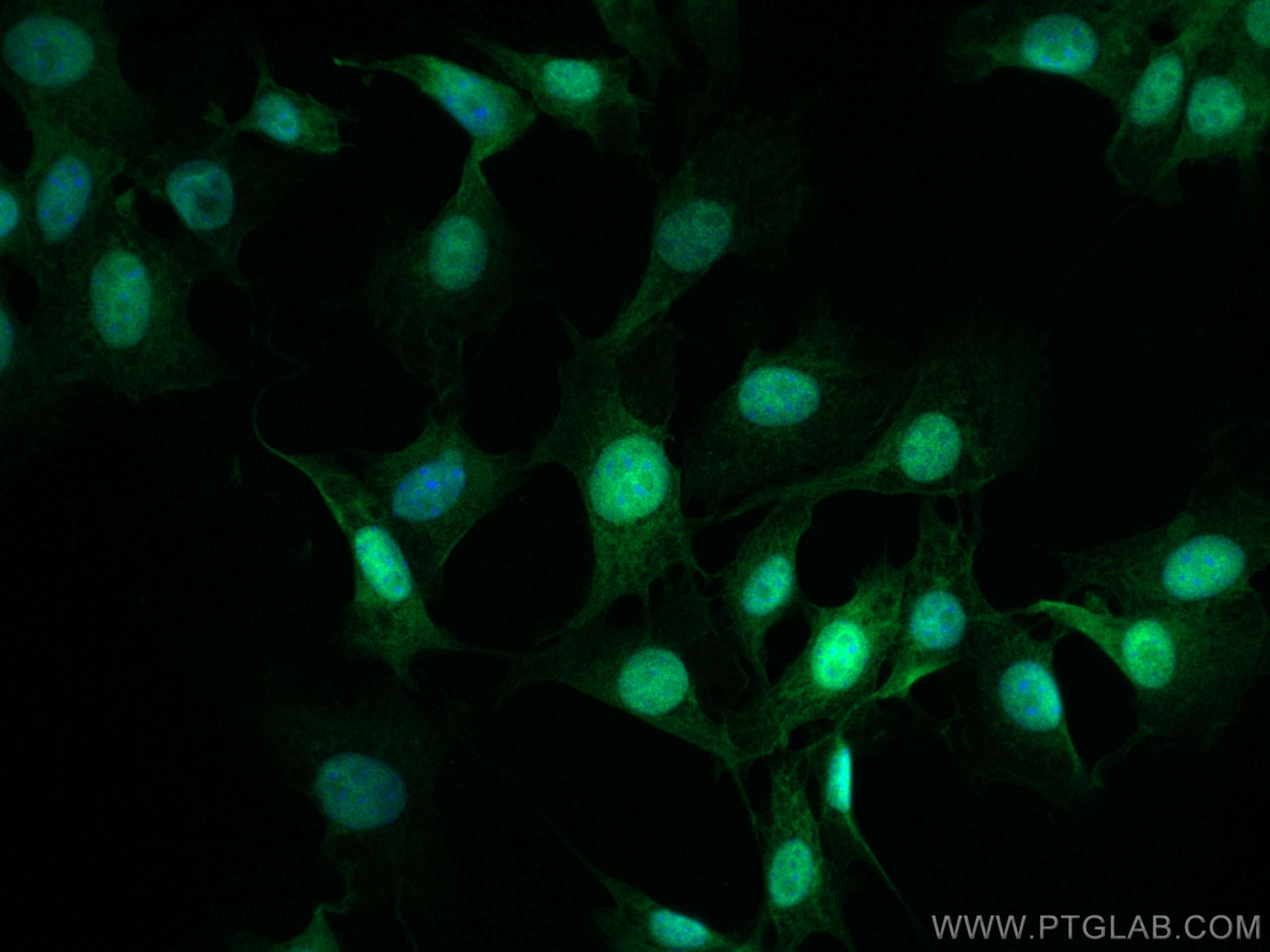 Immunofluorescence (IF) / fluorescent staining of NIH/3T3 cells using PIN1 Polyclonal antibody (10495-1-AP)