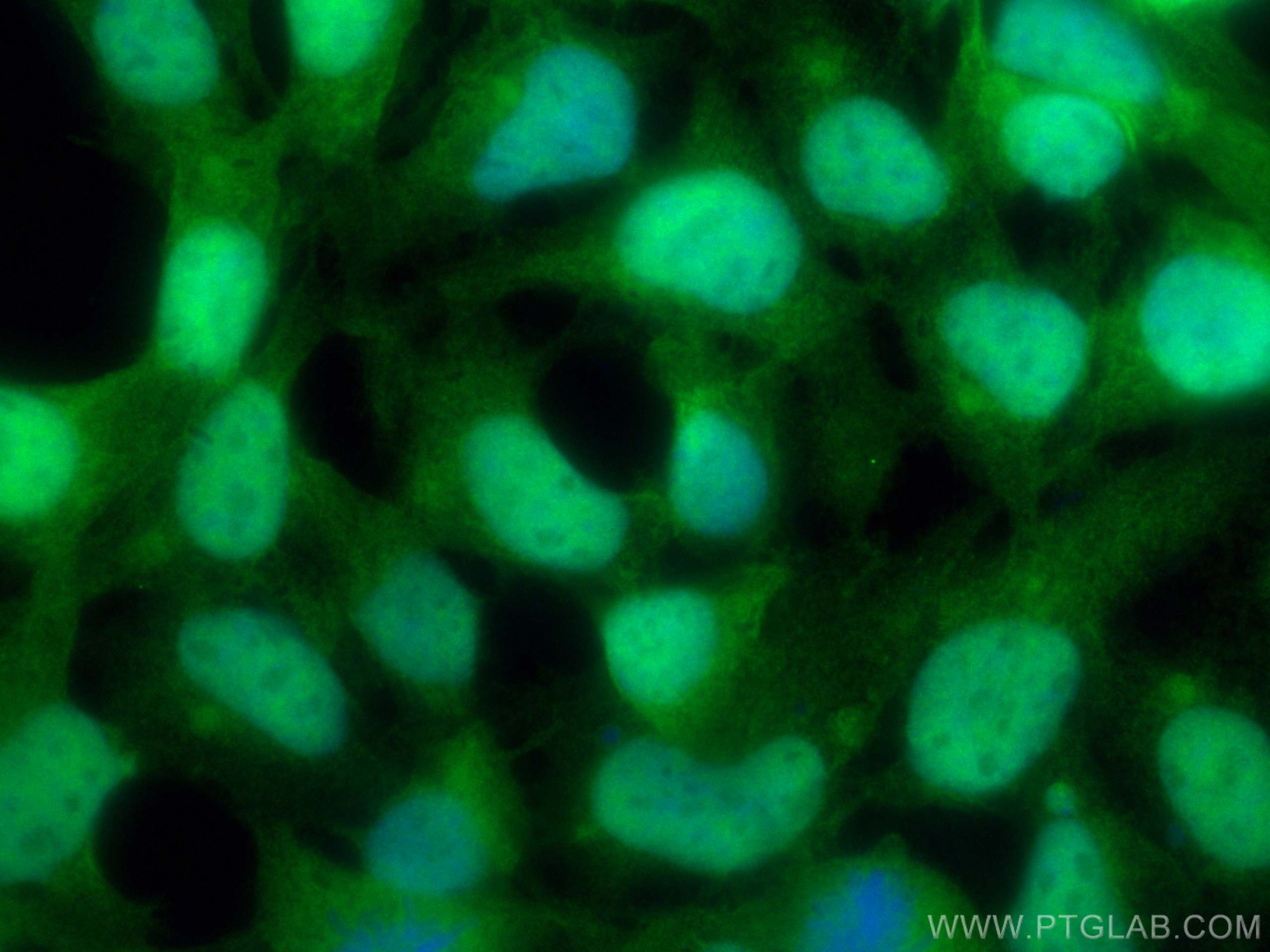 Immunofluorescence (IF) / fluorescent staining of HEK-293 cells using PIN1 Polyclonal antibody (10495-1-AP)