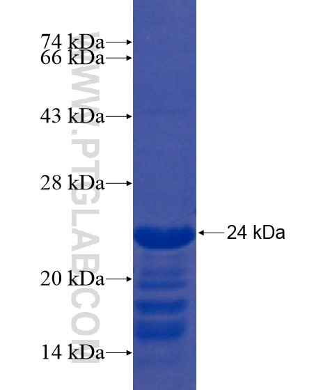 PIN1 fusion protein Ag21449 SDS-PAGE