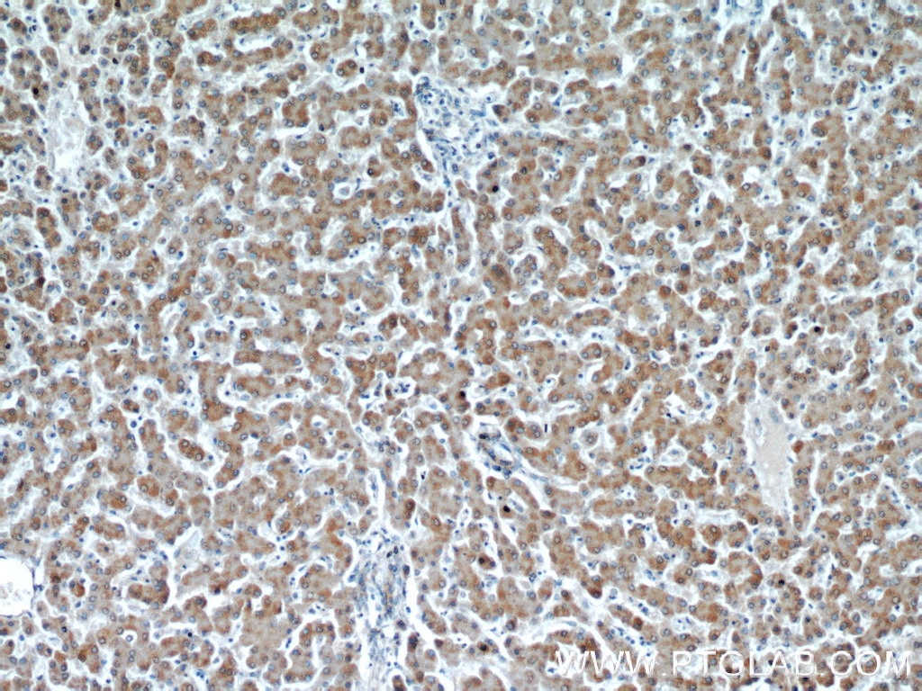 Immunohistochemistry (IHC) staining of human liver tissue using PIN4 Polyclonal antibody (15789-1-AP)
