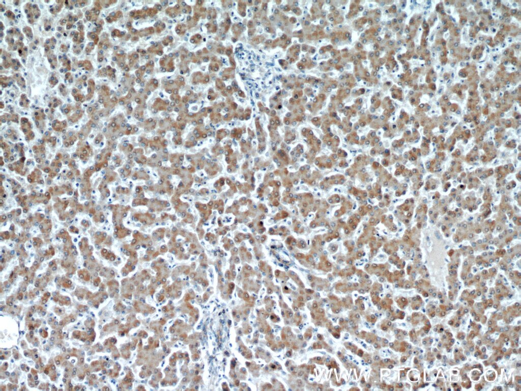 Immunohistochemistry (IHC) staining of human liver tissue using PIN4 Polyclonal antibody (15789-1-AP)