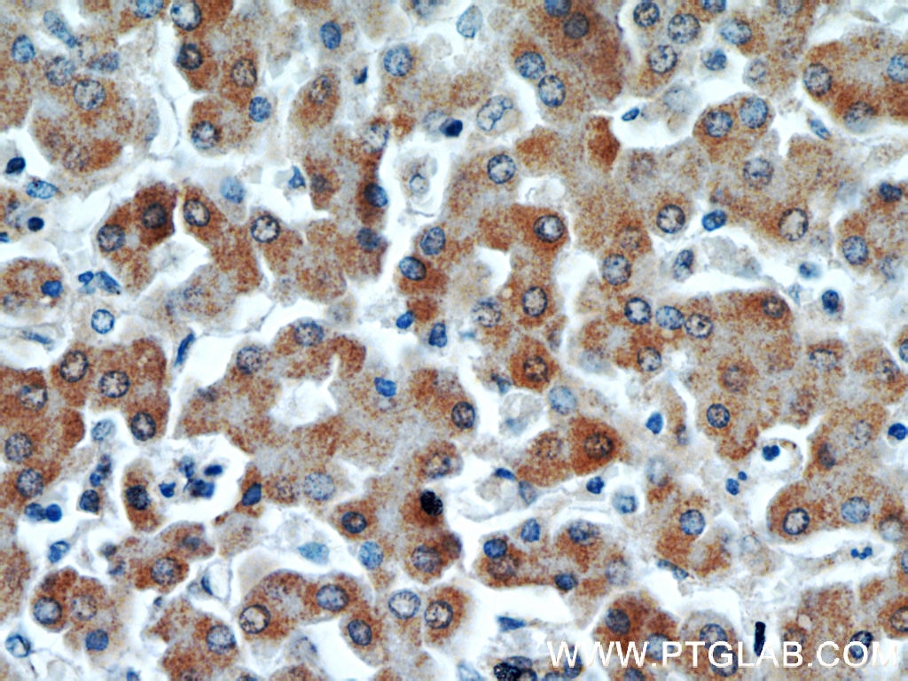 Immunohistochemistry (IHC) staining of human liver tissue using PIN4 Polyclonal antibody (15789-1-AP)