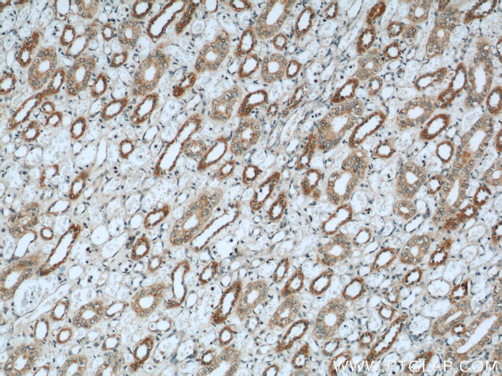 Immunohistochemistry (IHC) staining of human kidney tissue using PIN4 Polyclonal antibody (15789-1-AP)