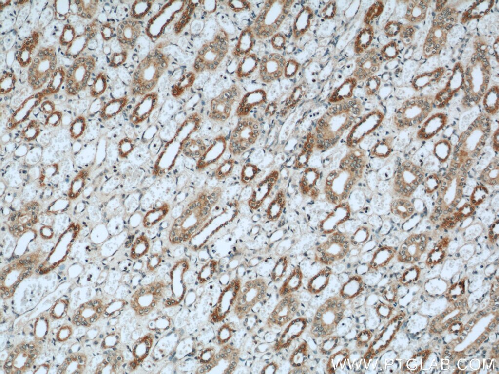 IHC staining of human kidney using 15789-1-AP