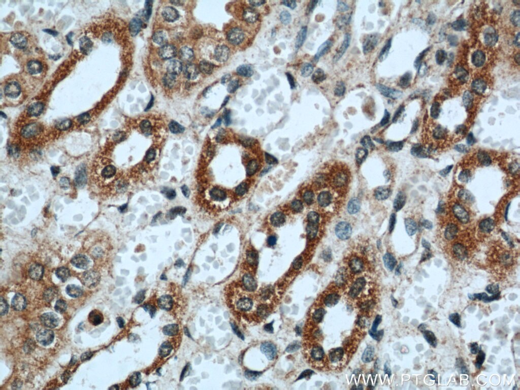 Immunohistochemistry (IHC) staining of human kidney tissue using PIN4 Polyclonal antibody (15789-1-AP)
