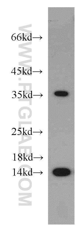 Western Blot (WB) analysis of HeLa cells using PIN4 Polyclonal antibody (15789-1-AP)