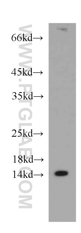 Western Blot (WB) analysis of HeLa cells using PIN4 Polyclonal antibody (15789-1-AP)