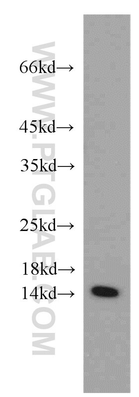 Western Blot (WB) analysis of mouse liver tissue using PIN4 Polyclonal antibody (15789-1-AP)