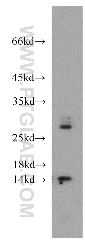 Western Blot (WB) analysis of mouse liver tissue using PIN4 Polyclonal antibody (15789-1-AP)