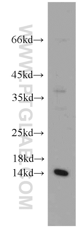 Western Blot (WB) analysis of mouse brain tissue using PIN4 Polyclonal antibody (15789-1-AP)