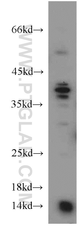 Western Blot (WB) analysis of mouse kidney tissue using PIN4 Polyclonal antibody (15789-1-AP)
