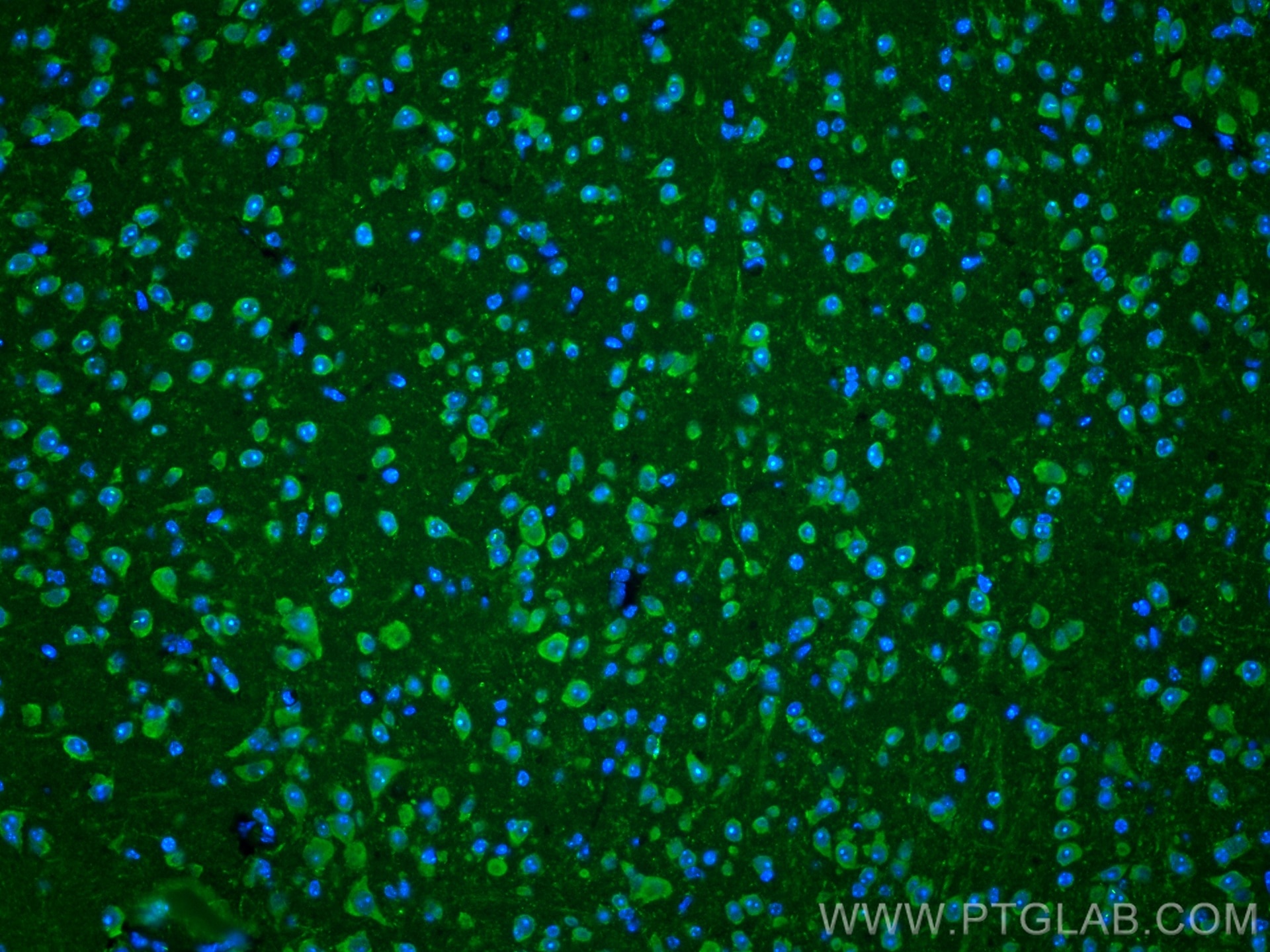 Immunofluorescence (IF) / fluorescent staining of mouse brain tissue using PINK1 Polyclonal antibody (23274-1-AP)