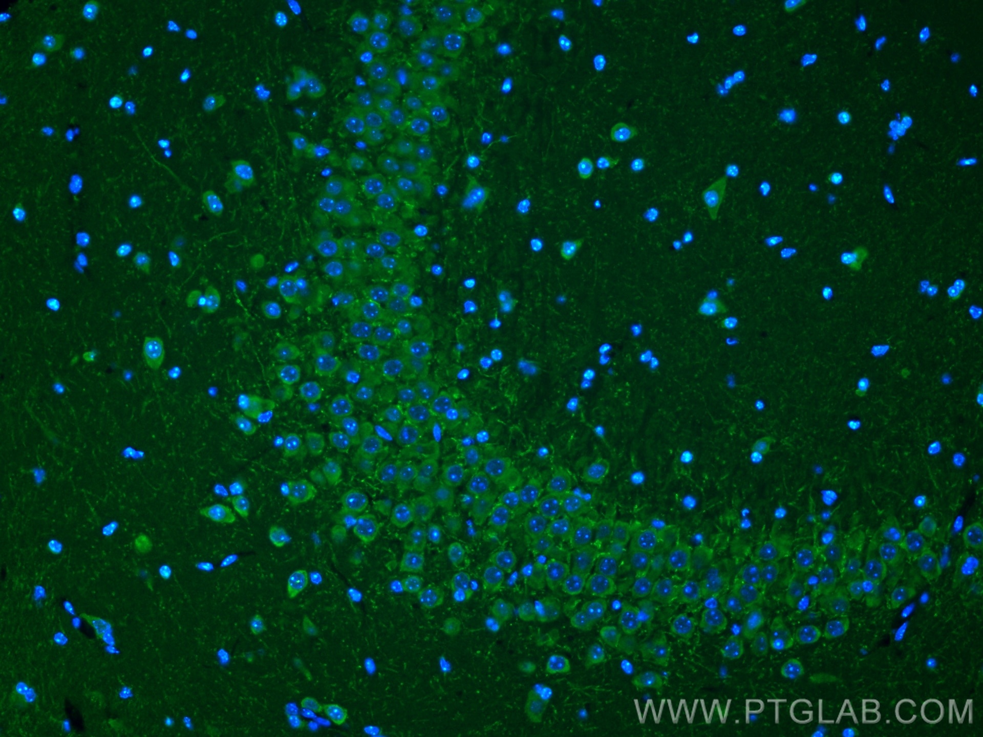 Immunofluorescence (IF) / fluorescent staining of mouse brain tissue using PINK1 Polyclonal antibody (23274-1-AP)