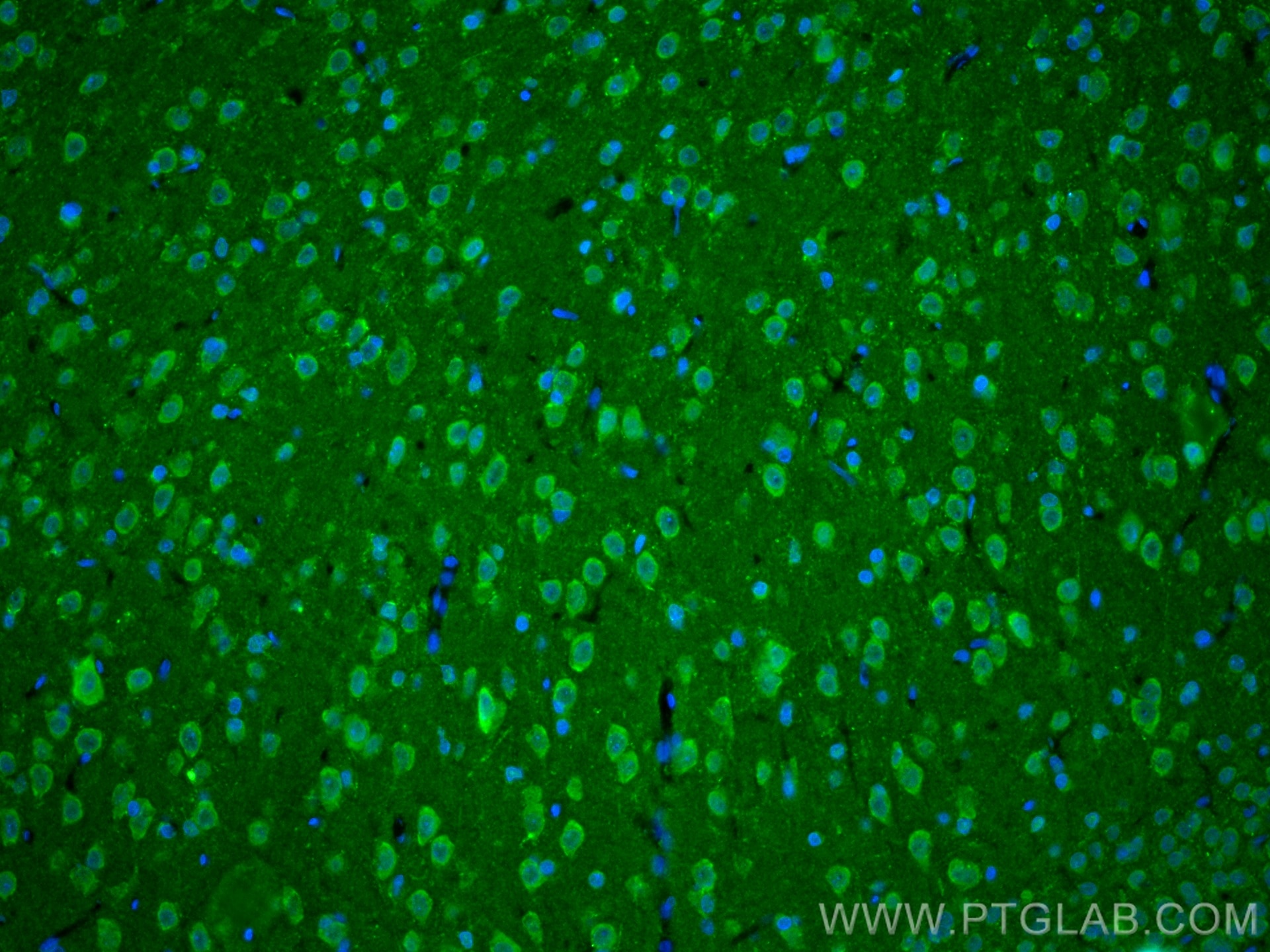 Immunofluorescence (IF) / fluorescent staining of rat brain tissue using PINK1 Polyclonal antibody (23274-1-AP)