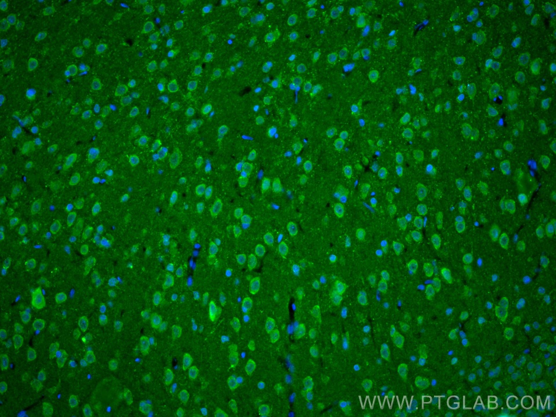 IF Staining of rat brain using 23274-1-AP