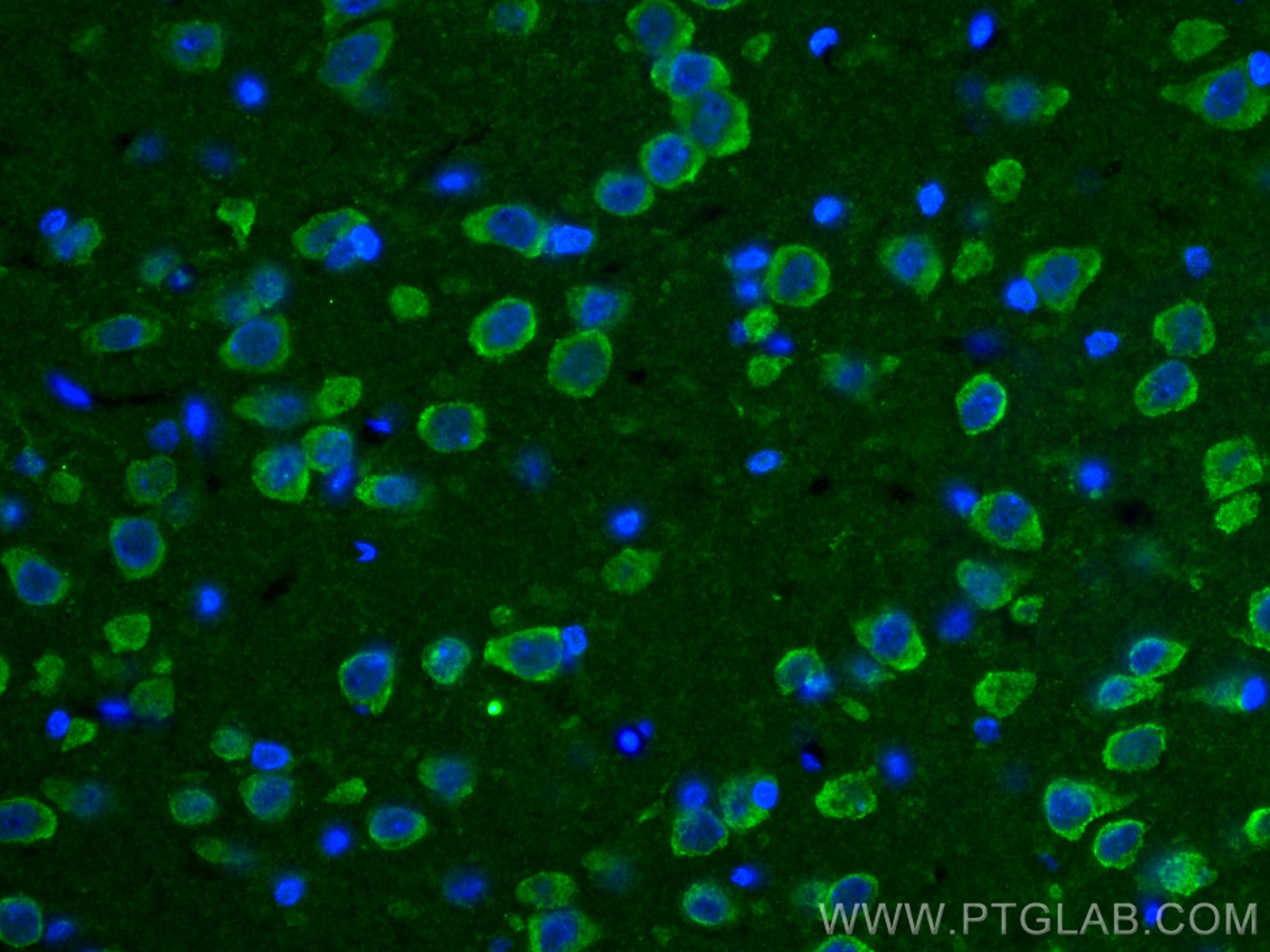 Immunofluorescence (IF) / fluorescent staining of rat brain tissue using PINK1 Polyclonal antibody (23274-1-AP)