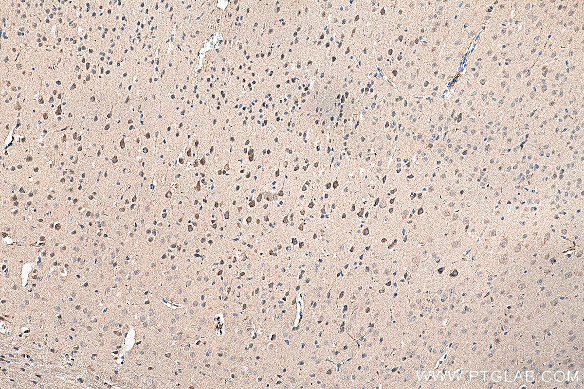 Immunohistochemistry (IHC) staining of mouse brain tissue using PINK1 Polyclonal antibody (23274-1-AP)