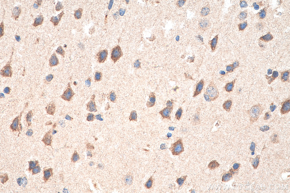 Immunohistochemistry (IHC) staining of mouse brain tissue using PINK1 Polyclonal antibody (23274-1-AP)
