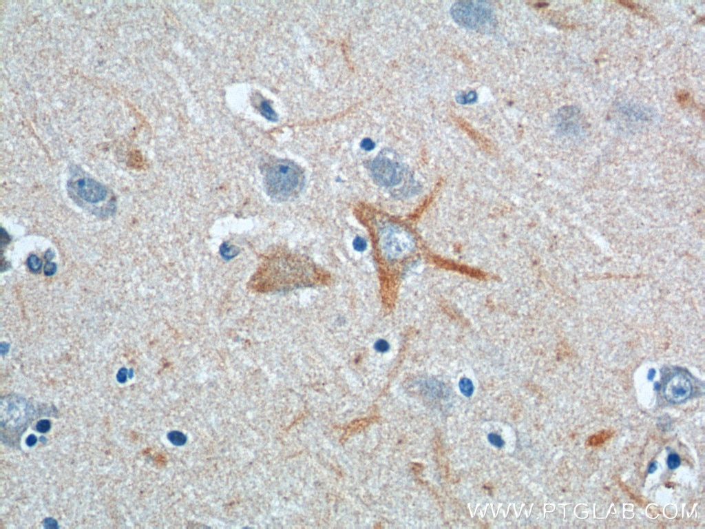 Immunohistochemistry (IHC) staining of human brain tissue using PINK1 Polyclonal antibody (23274-1-AP)