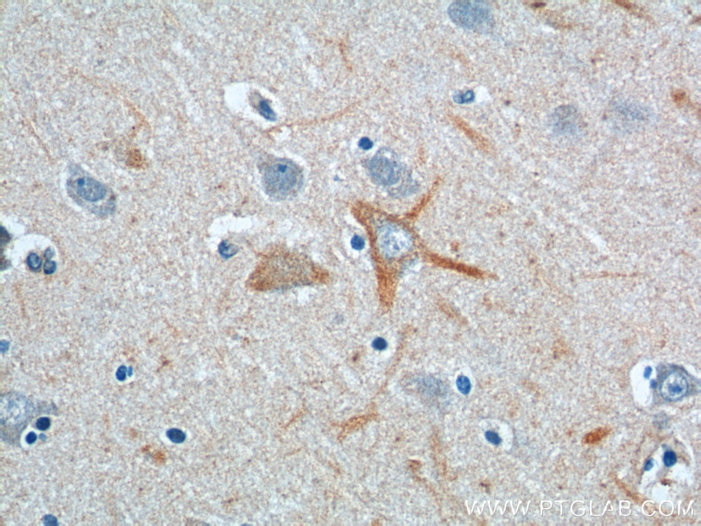 IHC staining of human brain using 23274-1-AP