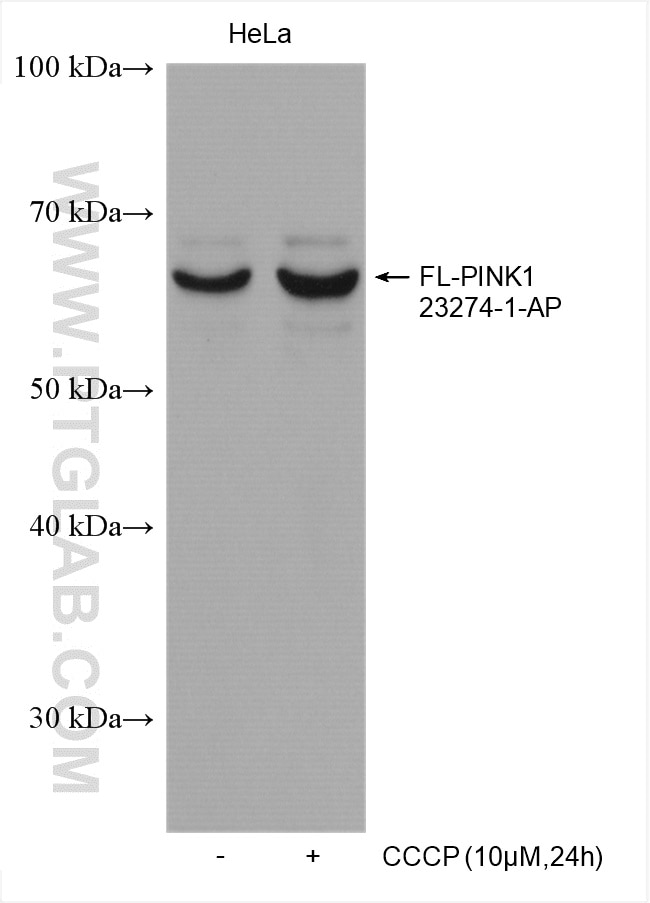 Western Blot (WB) analysis of various lysates using PINK1 Polyclonal antibody (23274-1-AP)