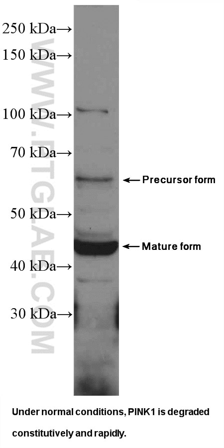 WB analysis of HeLa using 23274-1-AP